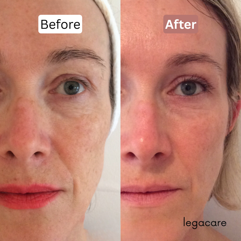 Anti-Aging Multi Balm